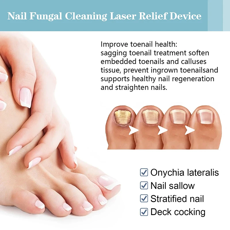 Fingernail Repair Device Fungus Laser Device Treatment Cold Therapy Onychomycosis Physical Therapy Professional Shining Nail