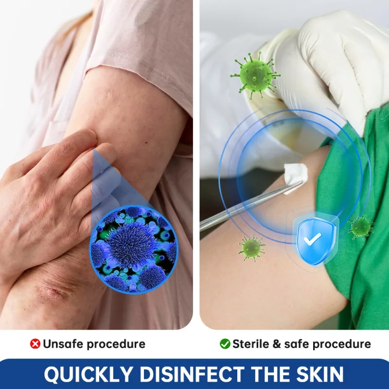 70% -80% ISOPROPYL ALCOHOL تطهير الكحول القابل للتصرف القطن علاج الجروح تنظيف المنزل تطهير ورقة القطن