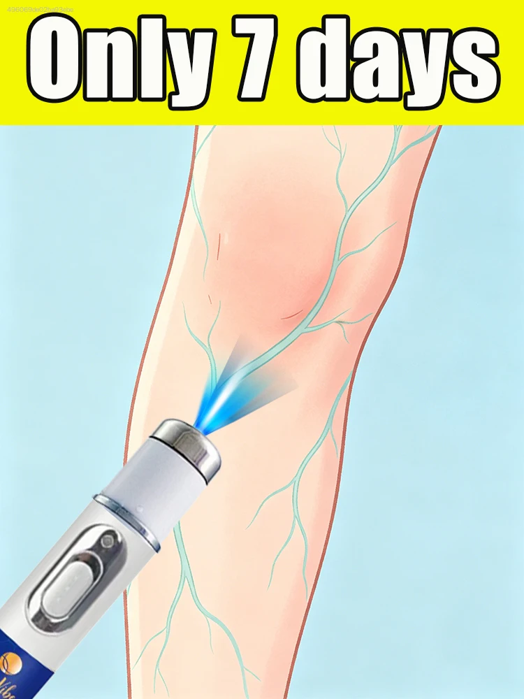 

Sitting or standing for long periods of time is quietly "destroying" your legs.