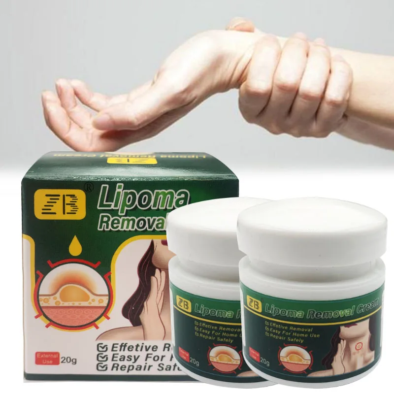 ZB 20g Pure Natural Chinese Herbal Lipoma Removal Cream Efficiently Removes Lipoma Fibroids Subcutaneous Lumps Body Health Care