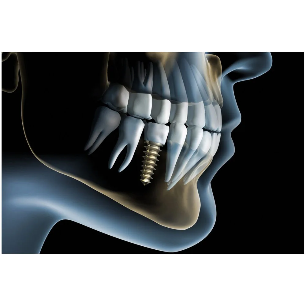 

Teeth Clinic Dental X-Ray Dentist Health Wall Art Print Pictures Posters Canvas Paintings for Living Room Decorations Home Decor