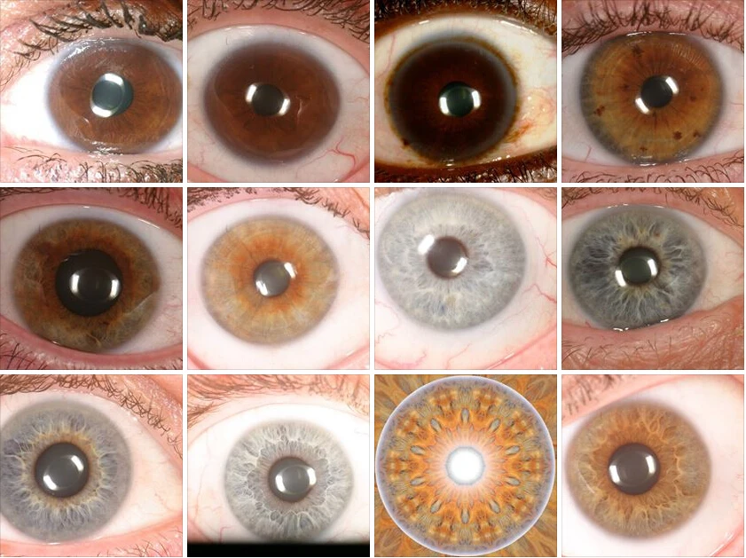 نظام Win10 مناسب لكاميرا Iidology للعين بدقة 12.00 ميجابكسل