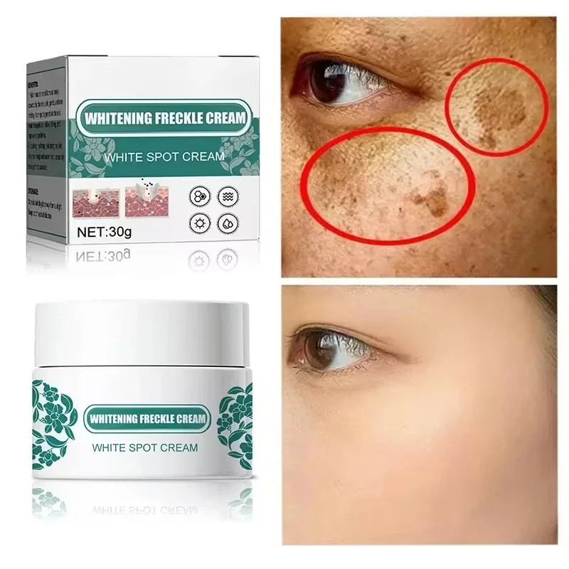 

eelhoe Niacinamide Melasma Brightening Cream Reduce Melanin Lighten Dark Skin Chloasma Serum Fade Fine Lines Korean Care Product