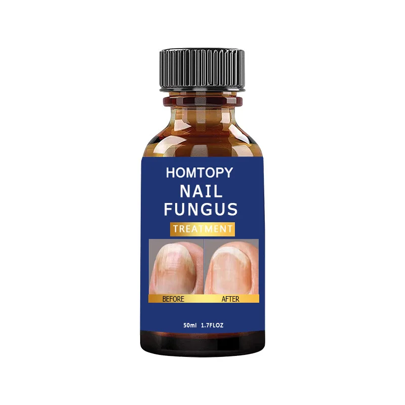 Nail Fungus Treatment Oil Feet Nails Repair Extra Strong Care Essence Anti Infection Paronychia Toe Fungal Removal Essence 50ml