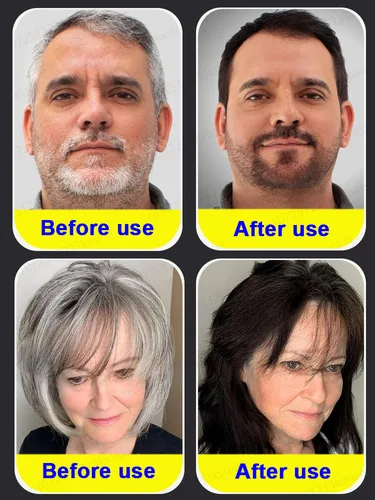 Imagen 2 del producto [Convierte el cabello en negro en 7 días] Esencia natural para cabello blanco a negro, extracto de ginseng, previene las canas, fortalece el cabello y repara los folículos pilosos.