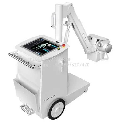 2026 NEW 8KW Portable Digital Radiography X Ray Machine, X-ray Equipments & Accessories