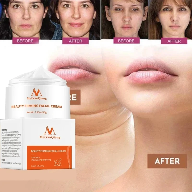 Meiyanqiong Firming Face Cream Moisturizing Whitening Face Care Anti-winkle Anti Aging V-face Thin Face Cream