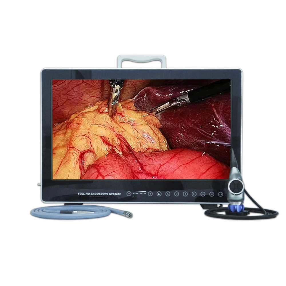 24 Inch Monitor Display 1080P Full HD Medical Endoscope Camera System with 80W Light Source