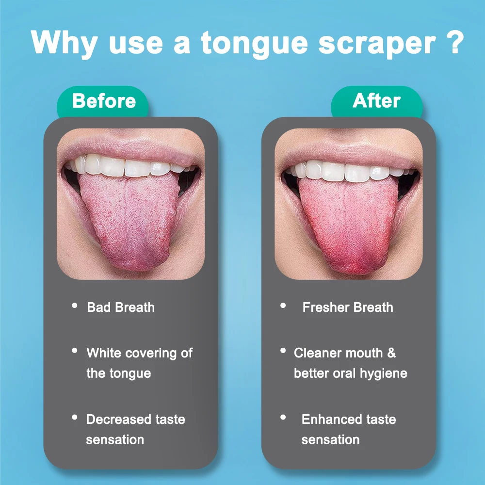 Thumbnail 4 - #68 Latest Tongue Scrapers Offers