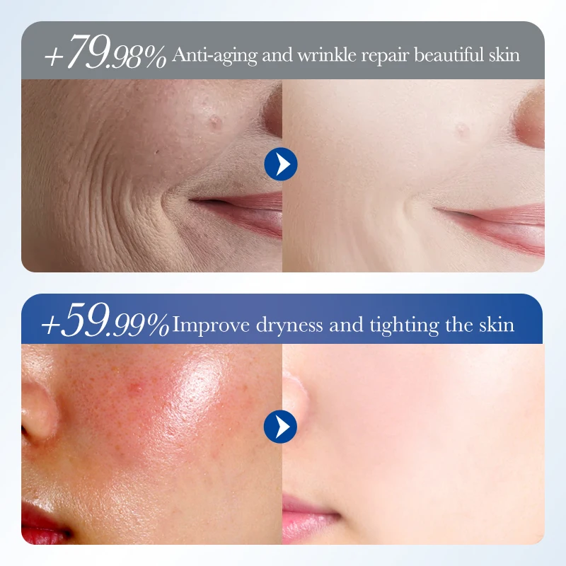 

Collagen Firming Repair Gel Anti-wrinkle Brighten Creams Care Face Aloe Moisturizing Facial Vera Skin Products Cream Skinca Z7F9