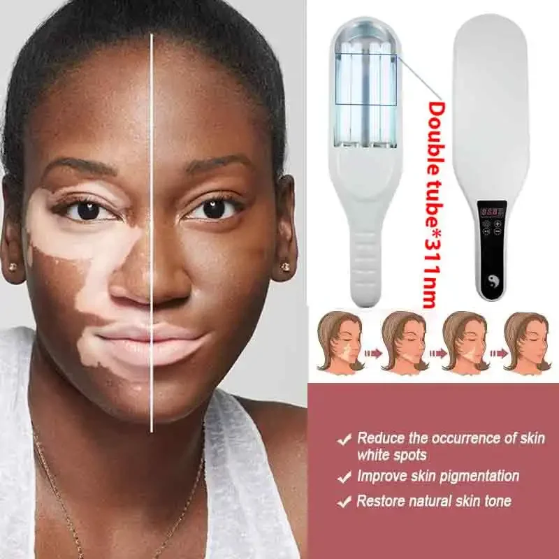 

Узкополосная лампа 311 нм (УВБ) может улучшить состояние кожи и подходит для лечения псориаза и витилиго.