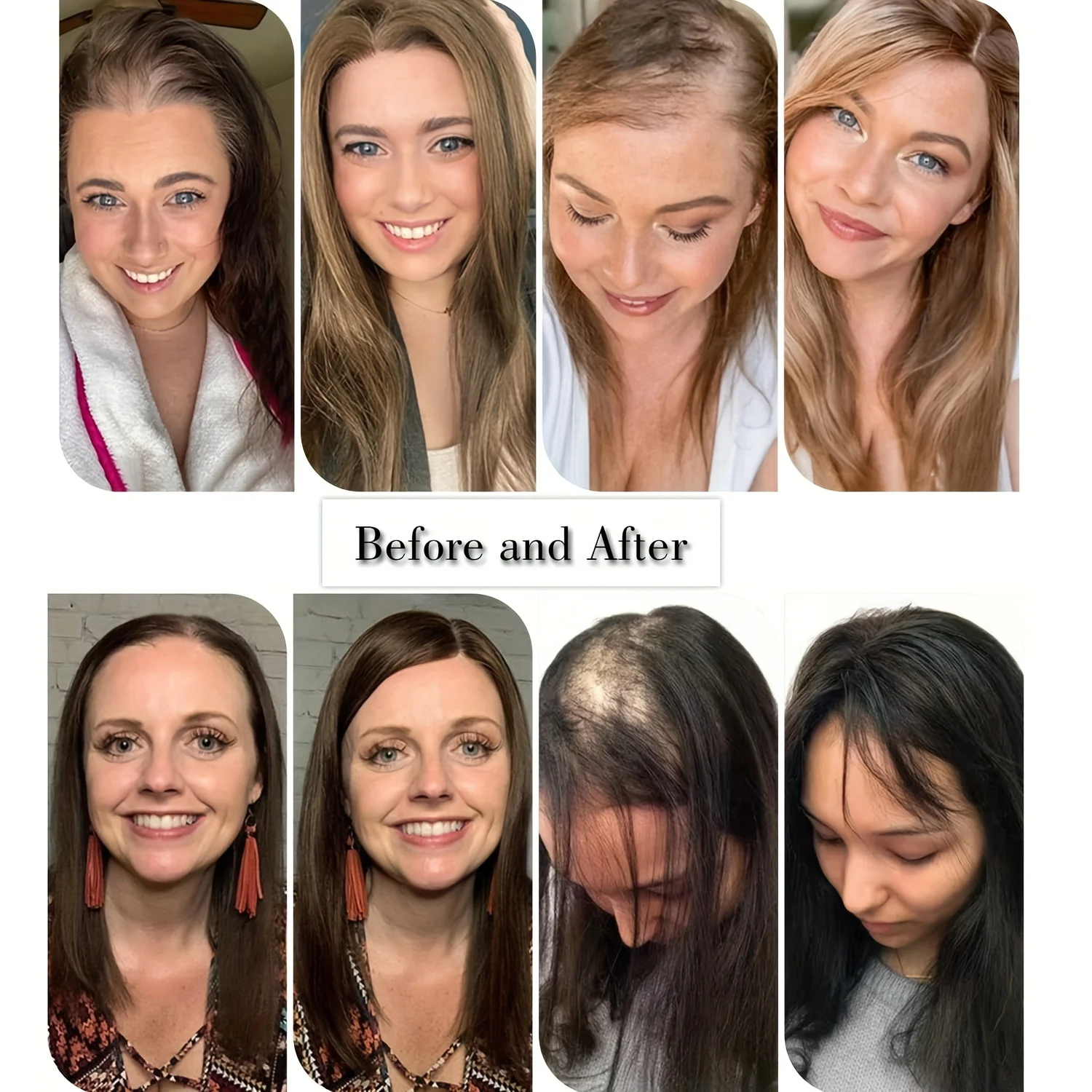 Syntetyczne nakładki na włosy dla kobiet z przerzedzającymi się włosami - 18 cali 6,5 x 6,5 cala Duże pokrycie Ombre Blonde Wiglets Kawałki włosów