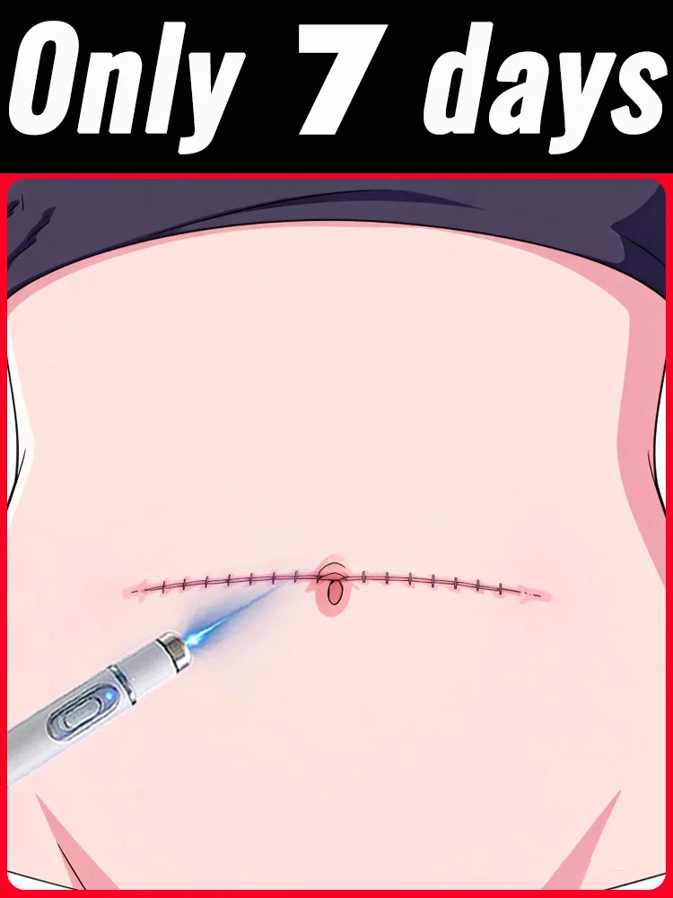 

Модернизированный шрам 2-го поколения ремонт корней шрамов uickly