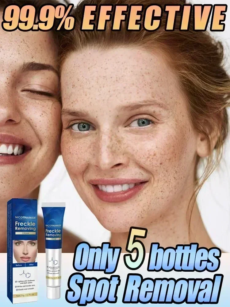 Effictive Dark Spot Remover cream for Face Removing Freckle Melasma Chloasma Senile Plaques Sunburn Cyasma Chorioplaque Freckle