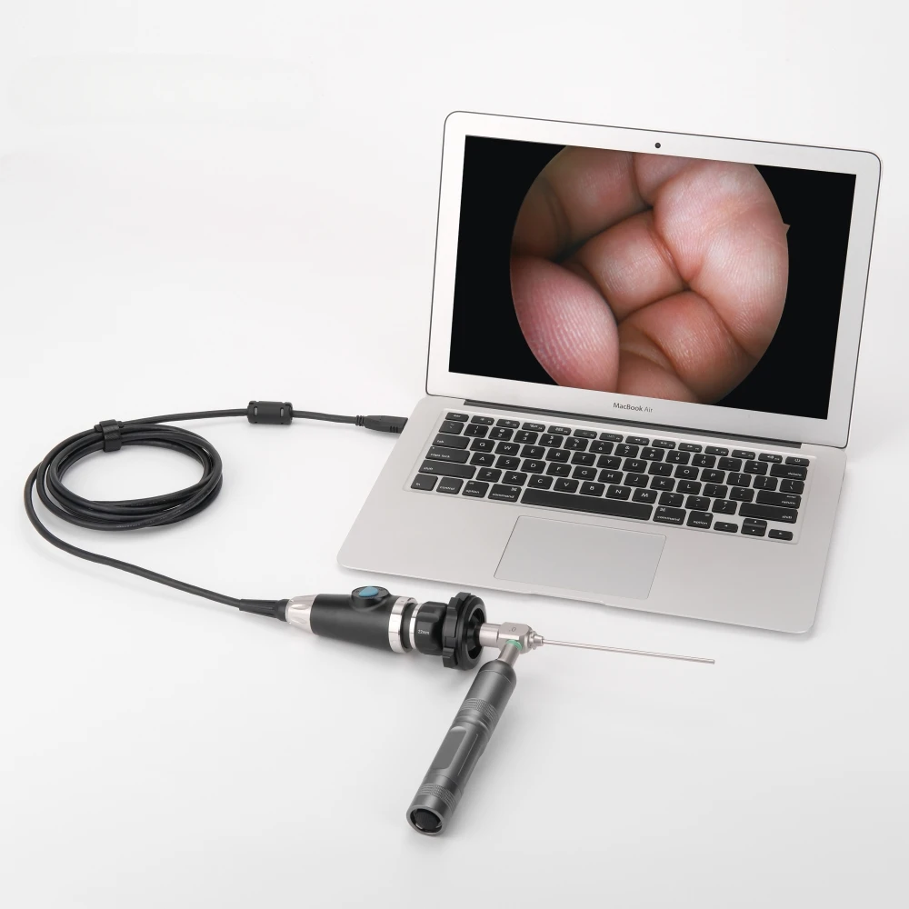 

Medical USB Endoscope Portable Full HD 1080P for ENT/Veterinary Inspection/Surgery Use