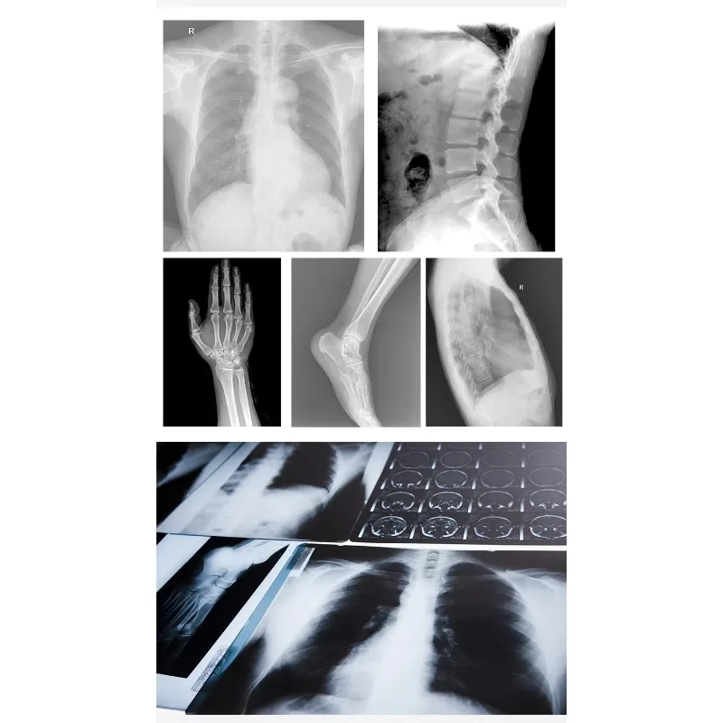 Factory direct sales portable x-ray machine 8-inch touch screen high-frequency x-ray human body or veterinary clinic hospital