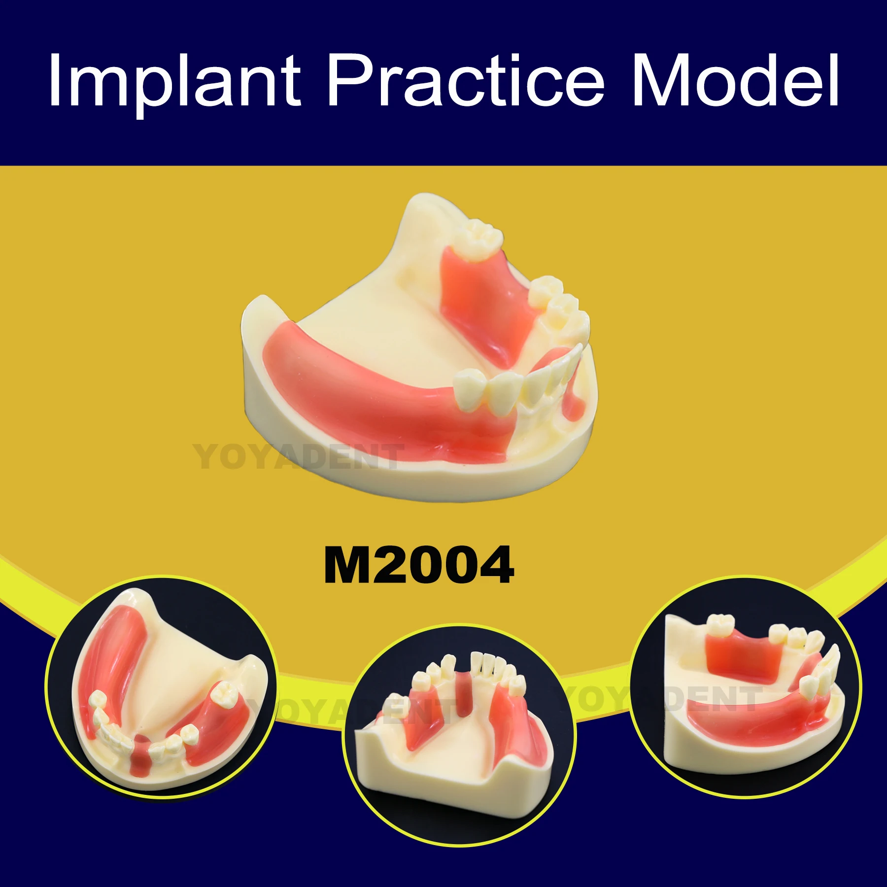 

Модель зубов зубного имплантата, съемная нижняя часть челюсти, обучение для обучения пациенту, демонстрационная модель для обучения студентов M2004