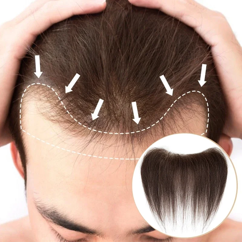 15Cm 100% Mensenhaar Mannen 4 # Kleur Pu V Lus Voorste Toupetje Haarlijn Pruiken Remy Hair Vervanging Steil Haarstuk 6Inch