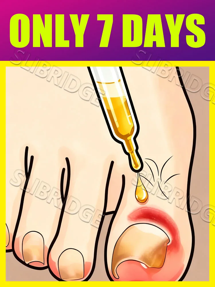 

Эфирное масло второго поколения 2025 года, 7 дней, обновление здоровья ногтей, восстановление, эфирное масло, бесплатная доставка