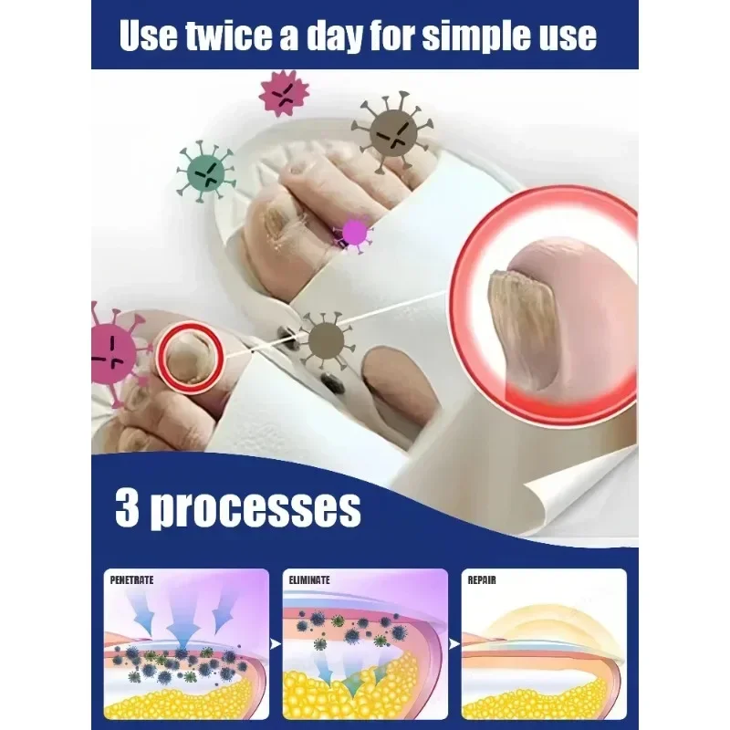 ᴹⁱˡᵈ ᵃⁿᵗᶦᵇᵃᶜᵗᵉʳᶦᵃˡ ⁿᵃⁱˡ ᵖʳᵒᵗᵉᶜᵗⁱᵒⁿ ᵗᵒ Prevent Nail Deformation and Falling Off