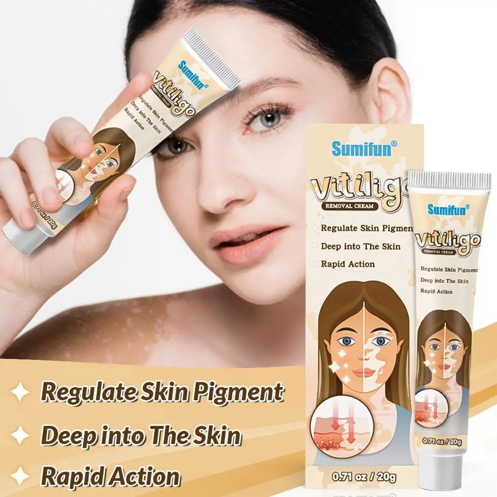 2PCS Vitiligo Treatment Repigmentation Improve Skin Pigmentation Fading Vitiligo Skin Appearance 20g