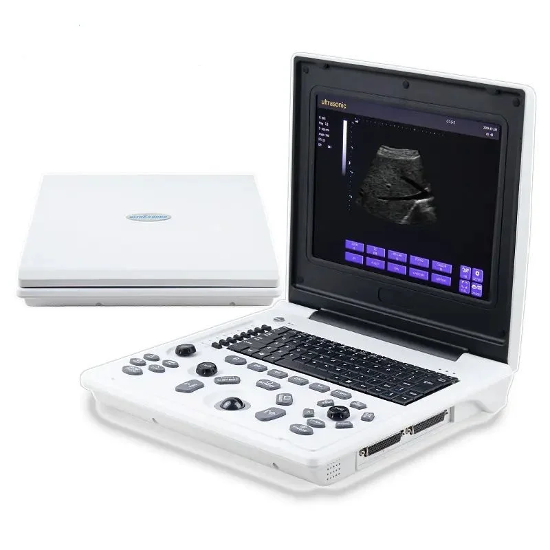 digital echocardiography instruments sonography use human laptop black and white portable medical ultrasound Scanner USG