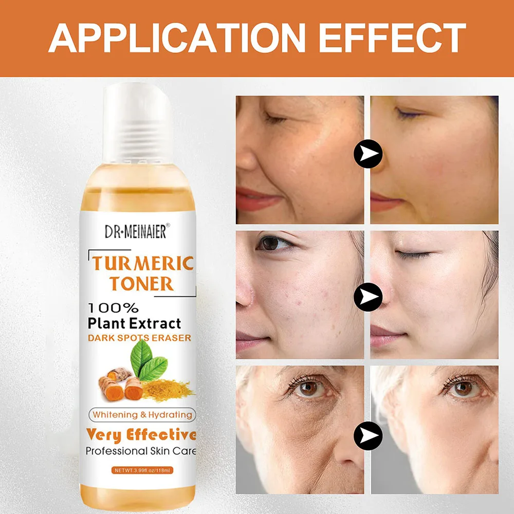 118ml Tumeric Dark Spots Toner Spots Eraser Corrector Turmeric Fade Blemishes Dark Spot Remover Acne Remover Toner for Dark Skin