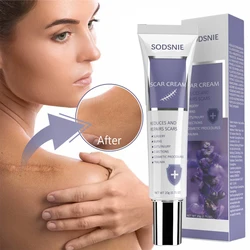 20g Scar Cream Skin Repair Scars Treatment Smooth Whitening Effective Remove Burn Stretch Marks Acne Spots Body Care Product