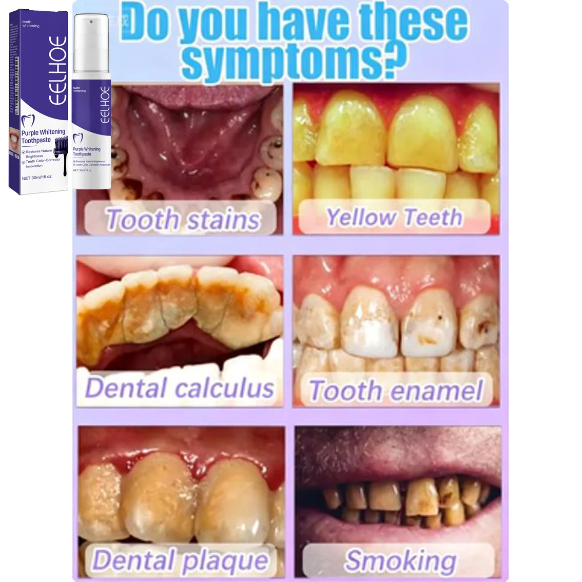 Tandenreiniging Whitening Tand - Teeth Whitening Korea recensie en prijs
