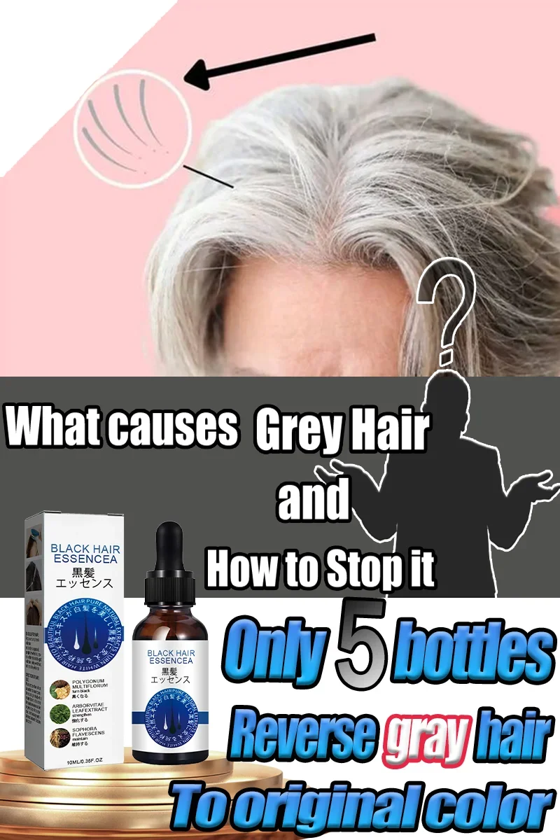 

Effective White Hair Care Serum Anti gray hair Reverse Gray to Original Color White Hair Treatment Nourish Scalp