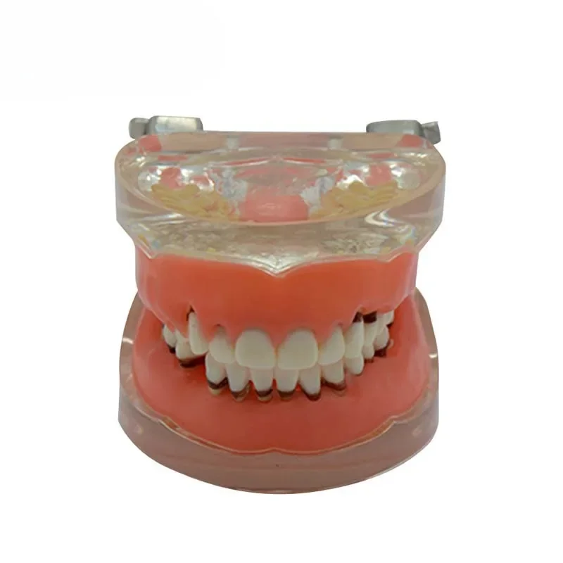 Pathology periodontal gingival disease model teaching