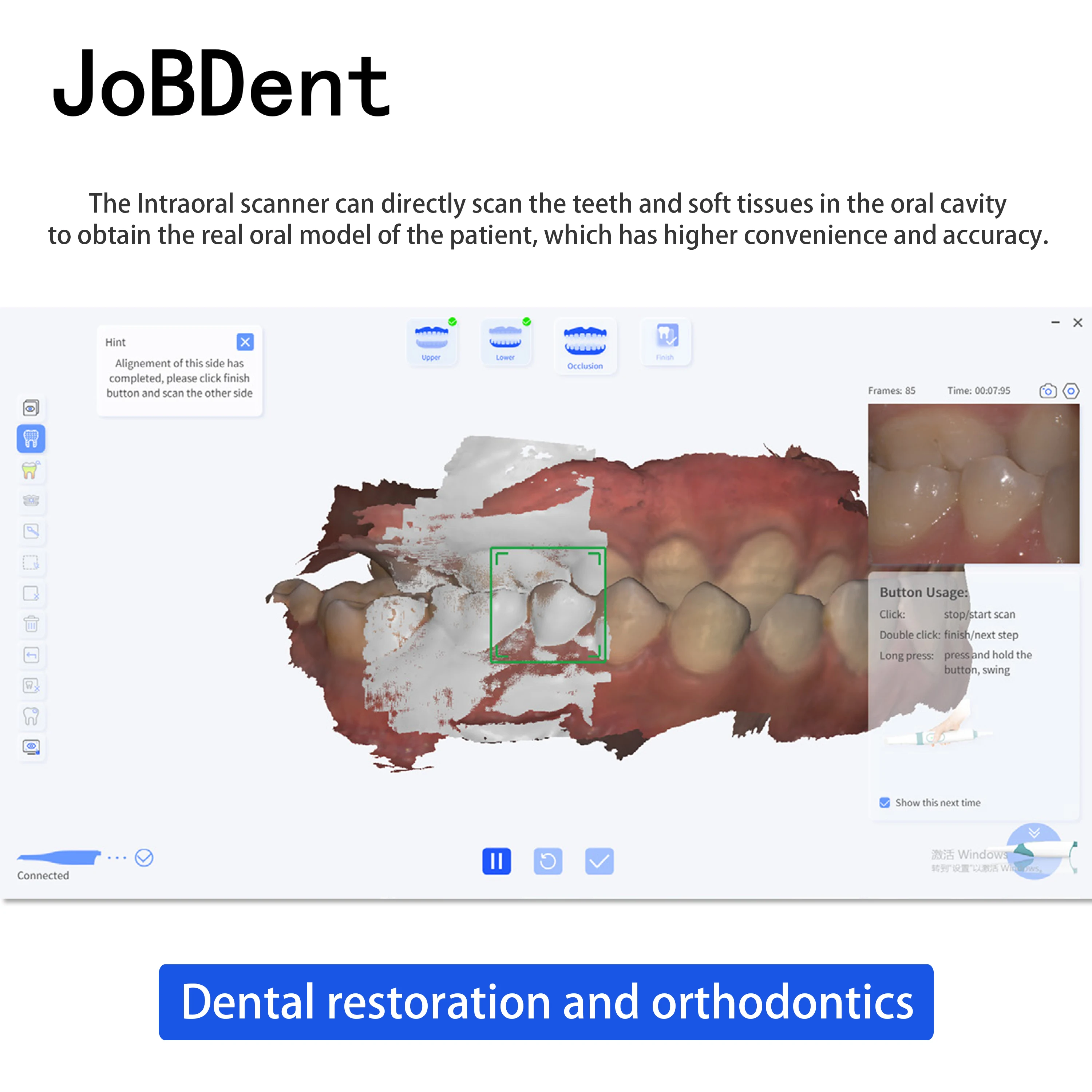 Digital Intraoral Velocidade Rápida AI Scan, Dental Inter Oral 3D Scanner