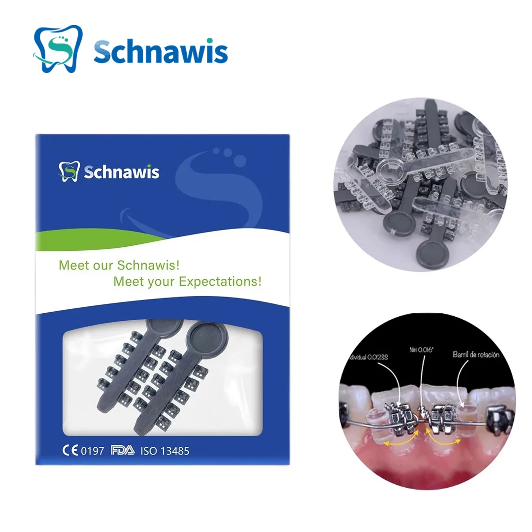 2Pcs/Bag Orthodontic Rotation Wedges – ברכס למשיכת שיניים מדויקת: חוות דעת מנוסה של מומחה בדנטה אורתודונטית