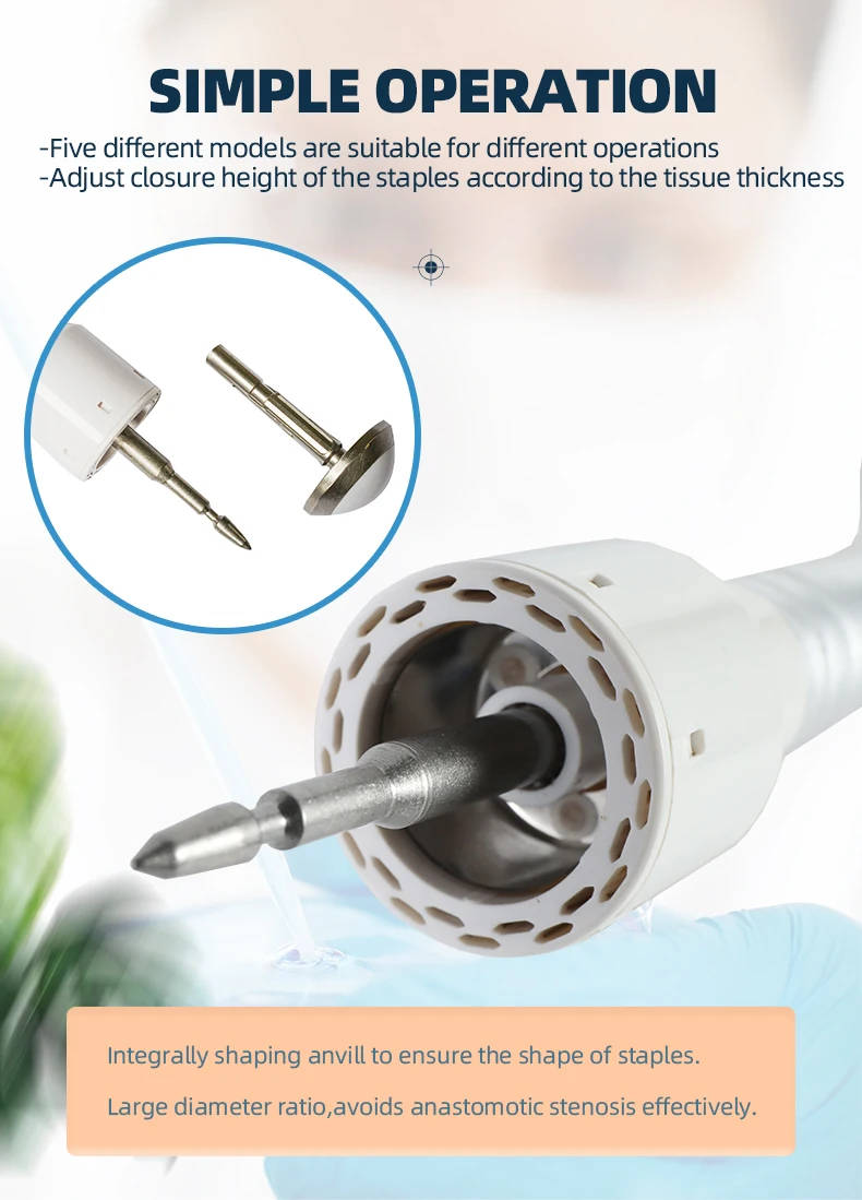 of Digestive Tracts Machinery Power Source Disposable Circular Electrical Stapler Operation Anastomosis