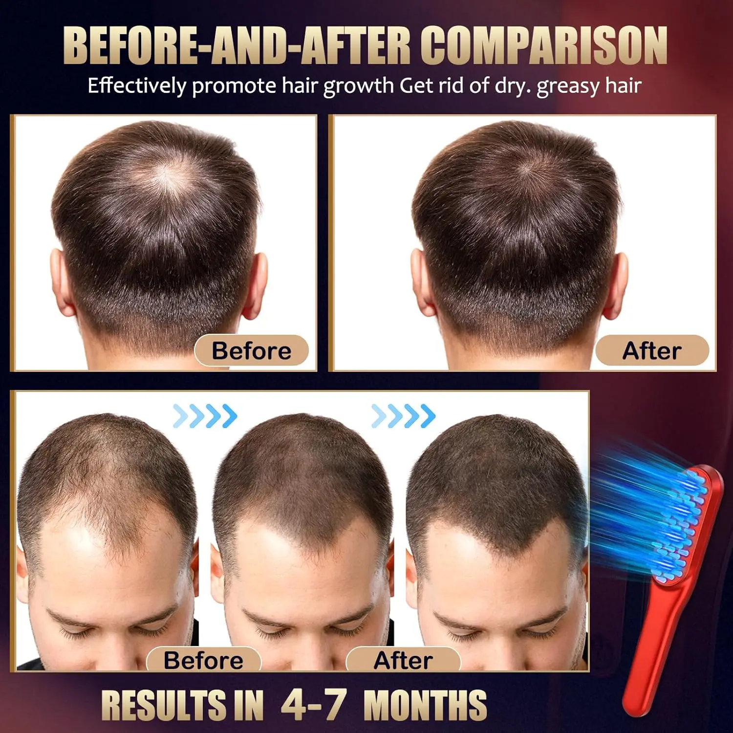 Laser Hair Growth Comb, Red Light Hair Growth Treatment Suitable for Both Men and Women view 6