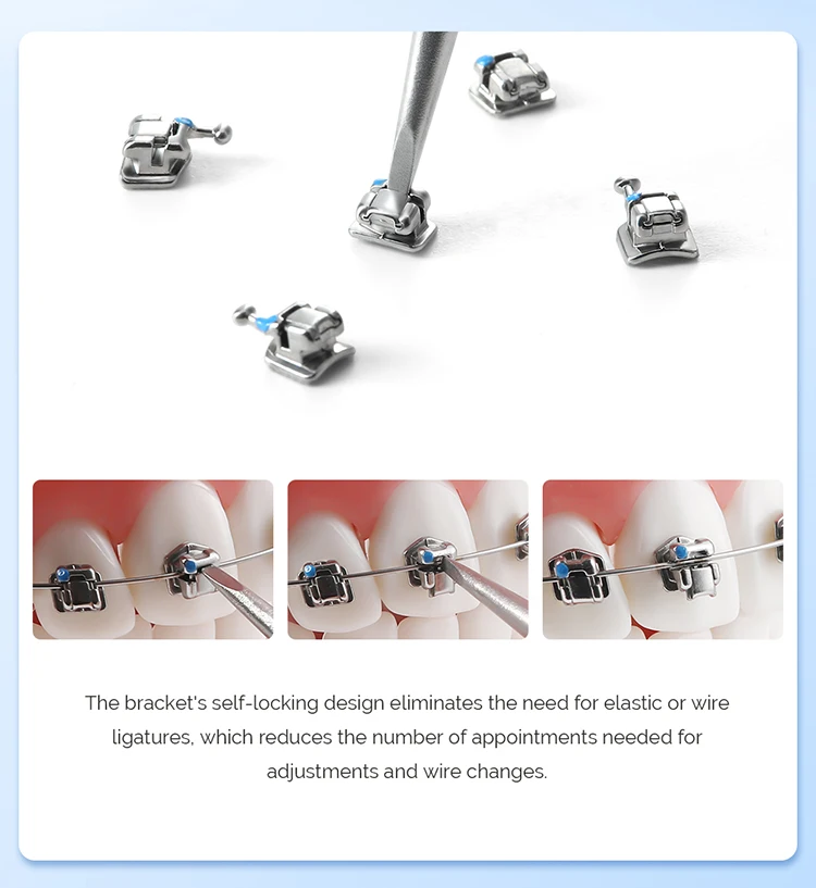 AZDENT Dental Kieferorthopädische Klammern Selbstligierende Zahnspangen Metall Monoblock MIM Roth/MBT 0,022 Haken 3-4-5 Zahnheilkundematerialien – Detail 2