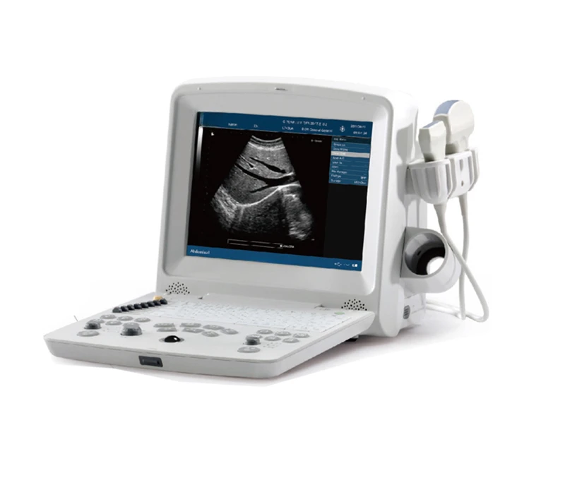 portable Edan ultrasound machine black and white ultrasound machines