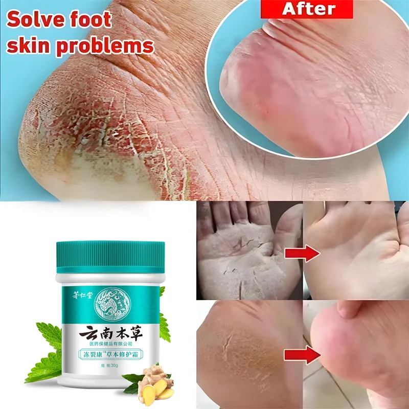 

Herbal Anti Crack Foot Cream Heel Cracking Repair Products Exfoliation Dead Skin Removal Softening Moisturize Smooth Skin Care