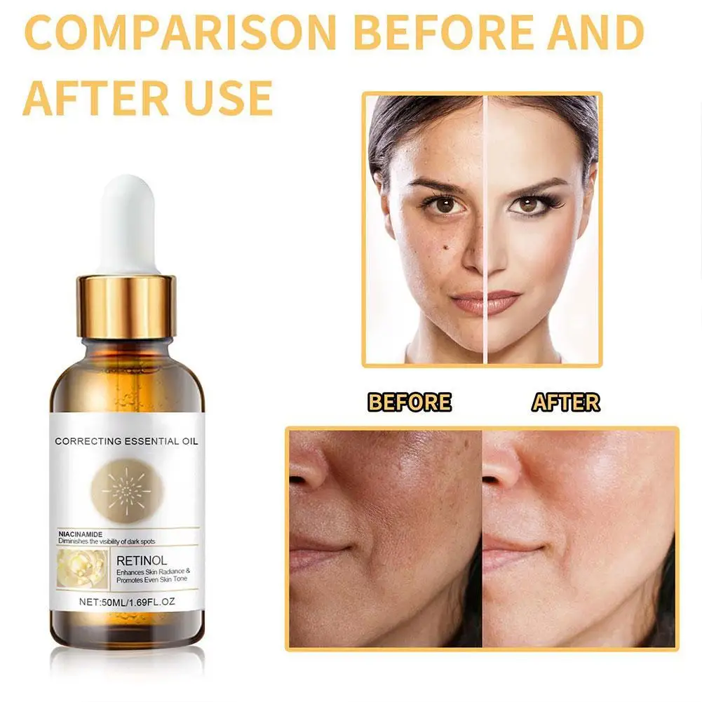 

1 шт., 50 мл сыворотка для лица, питательная сыворотка для контура лица, отбеливающая для лица, сужающая поры, средство для удаления пигментации, средства по уходу за кожей