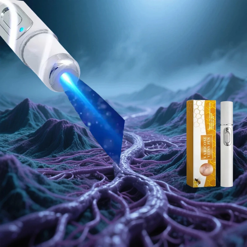 

1, лечение варикозного расширения вен для ног, лечение паукообразных вен для ног