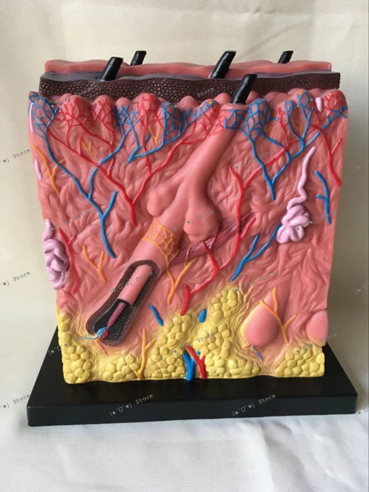 

Skin Structure Anatomical Model Acne Epidermis Anatomical Hierarchy Structure Suture Dermis Subcutaneous Tissue