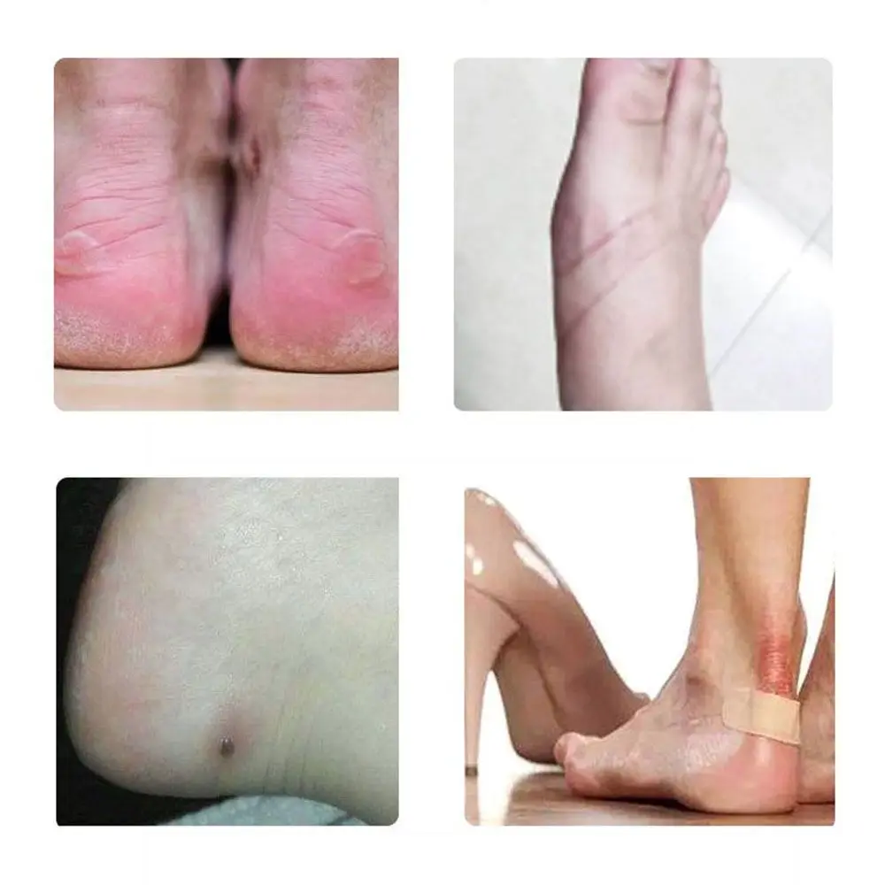 Anti Blister Waterproof Heel Patch Foot Care Prevent Corns Heel Sticker Heel Protectors Pads Heel Protector High Heels Grip