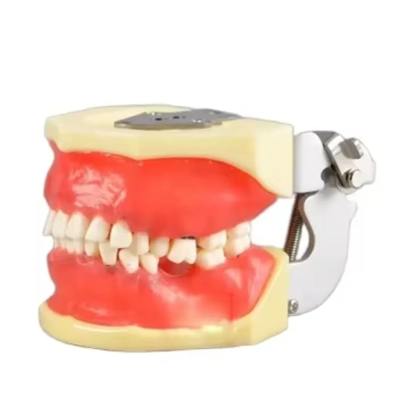 

YTYIN Periodontal Teeth Model For Demonstration Calculus,gingivae Recession And Gingivitis