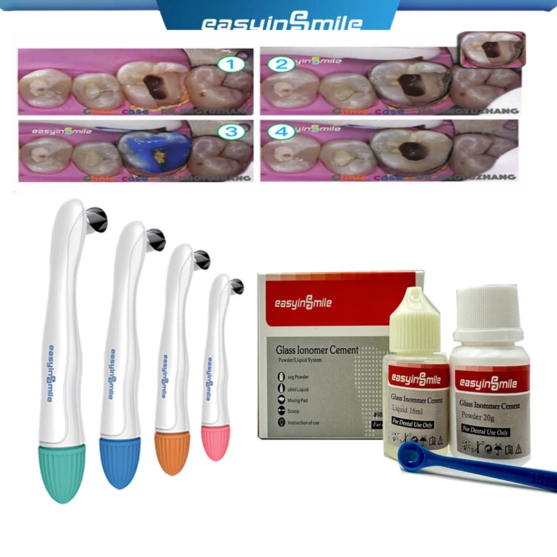 

EASYINSMILE Dental Pro матричная лента из нержавеющей стали, предварительно сформированная Корона, материал восстановления стандартного изогнутого стекла 4,5/6 мм, набор тономера