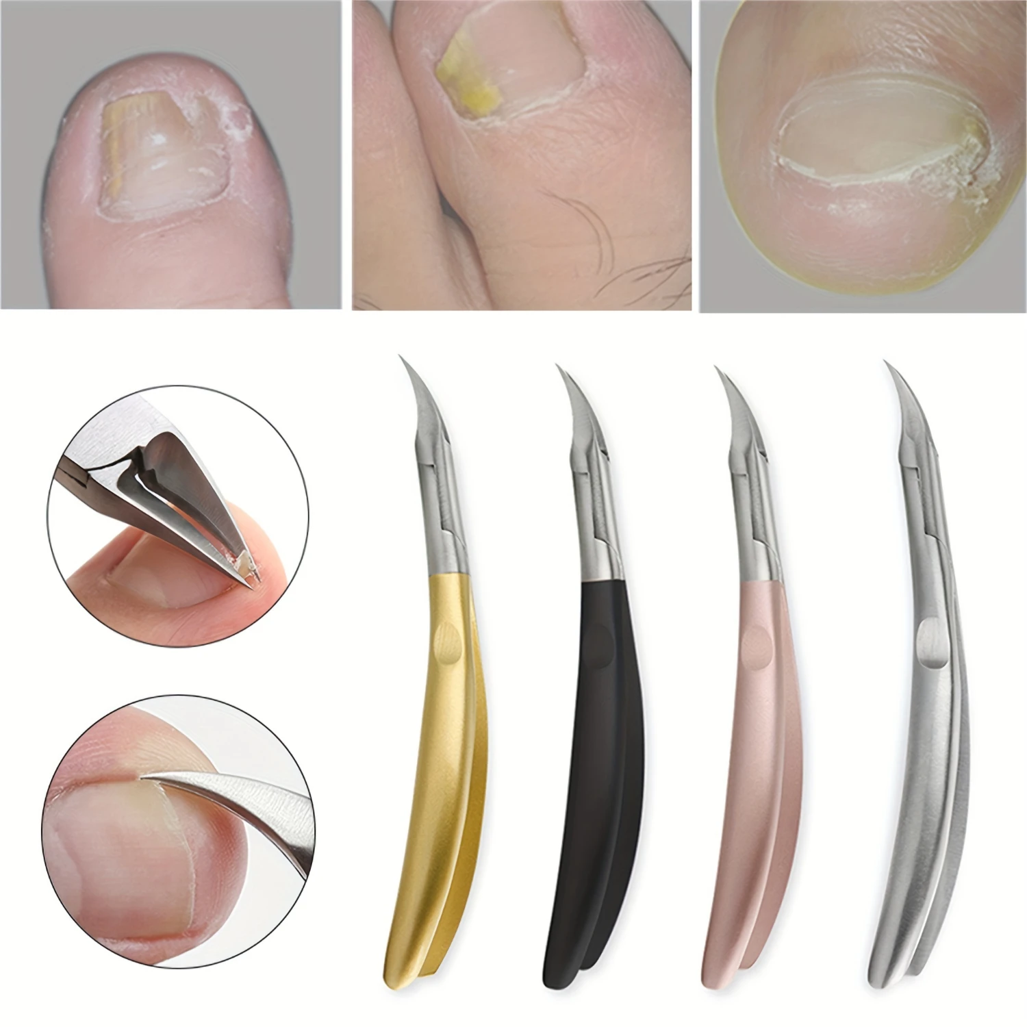 Precisie nagelriemtang en teennagelknipper - Hoogwaardig roestvrij staal, ergonomisch, ongeparfumeerd, gemakkelijk schoon te maken manicure en pedic