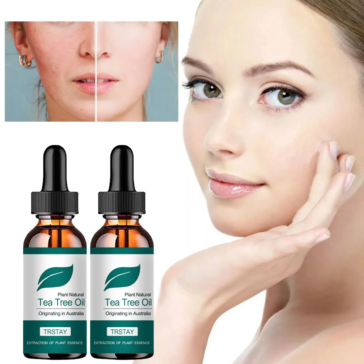 Plant Natural Tea Tree Oil Originating in Australia deep care improves facial scars, brightens skin tone, and revitalizes