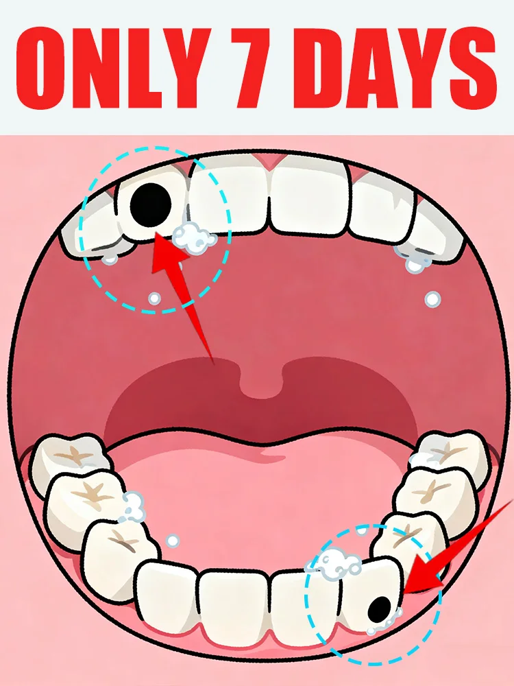 Generation-2 Bubbles pożegna się kamieni wewnątrz jamy ustnej w 7 dni