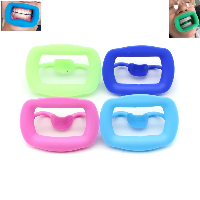 1pcs Dental Silicone Mouth Opener Orthodontic Cheek Retracor Tooth Intraoral Lip Cheek Retractor Soft Silicone Oral Care Tools