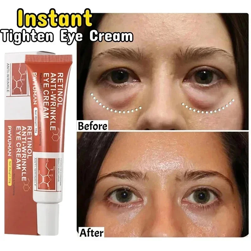 Instant Eye Bag Remove Eye Cream Anti Fat Particles Dark Circles Puffiness Fade Fine Lines Lift Brighten Korean Beauty Eye Care