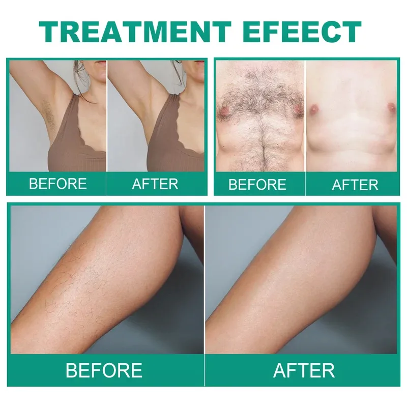 -Machine--- 2 In 1 Insulated Electric Pen Electrolysis Needle Hair Removal Device